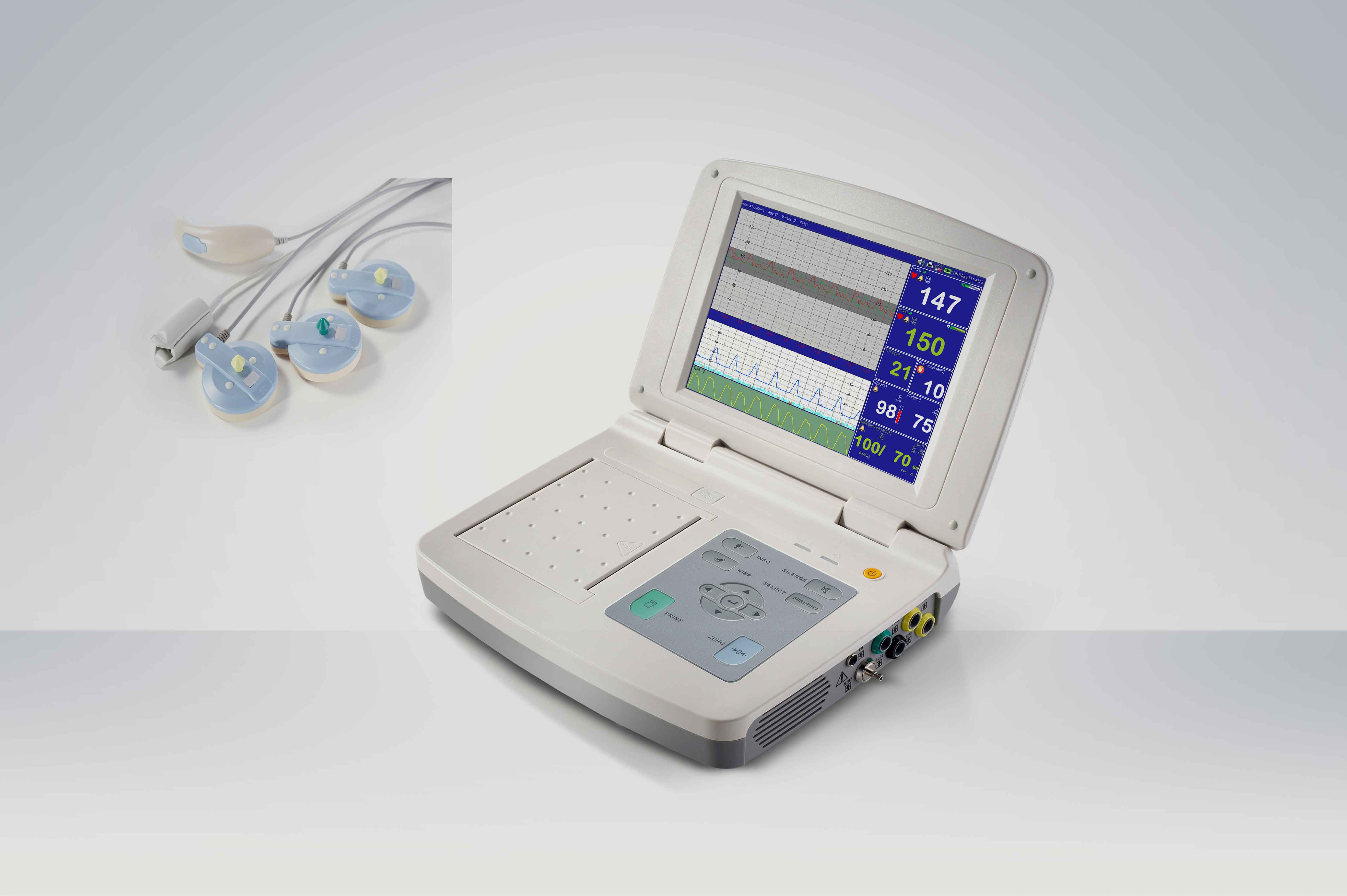 Fetal Monitor (CTG machine)