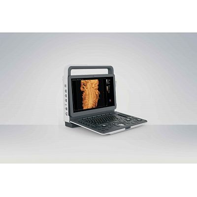 Color Doppler Ultrasound Diagnostic system